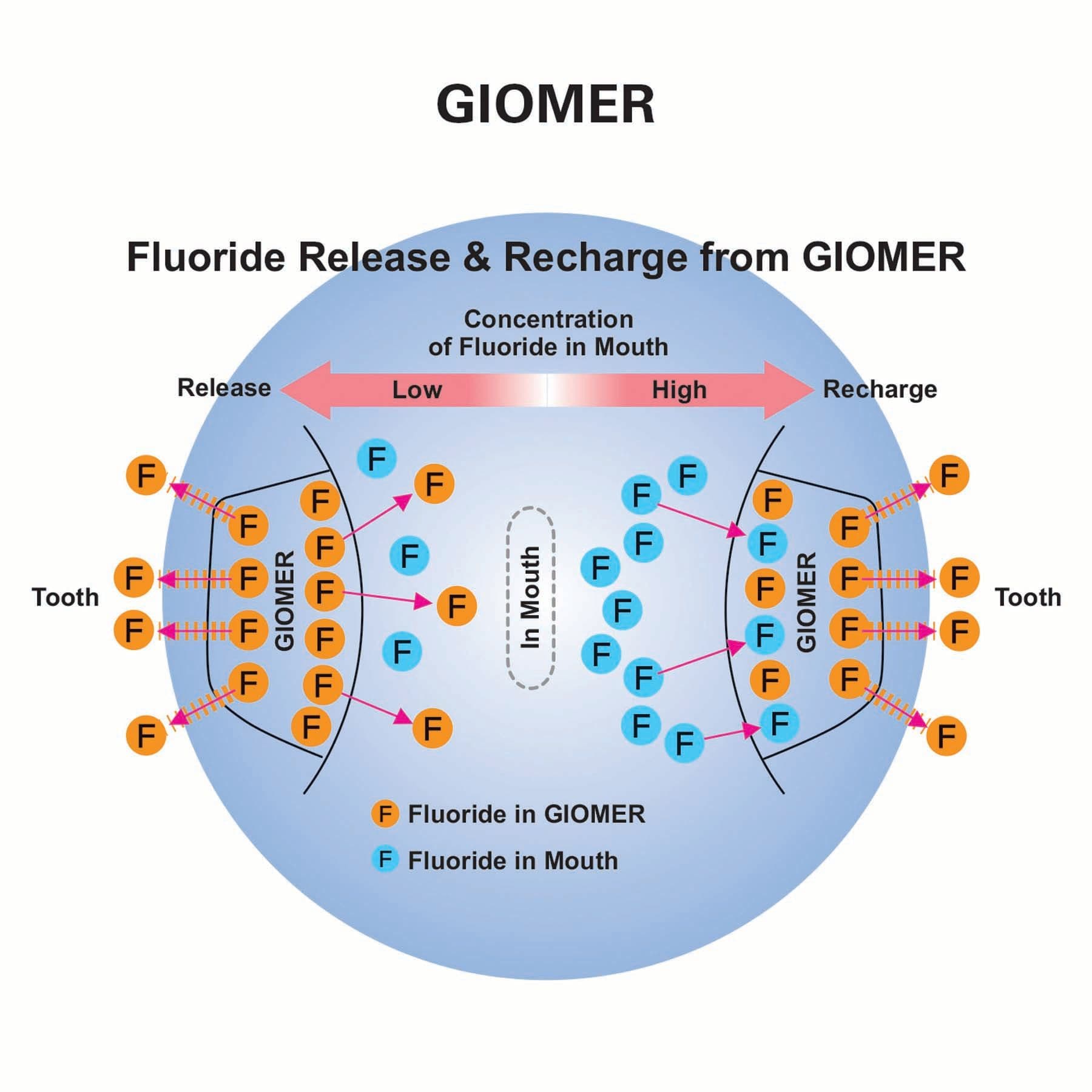 Figures 1-2. Giomer products have been proven in numerous clinical and laboratory studies to reduce secondary caries, neutralize acid, minimize sensitivity,and strengthen tooth structure. | Image Credit: © Shofu Dental Corp.