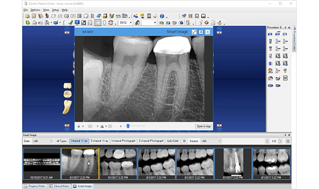 Dentrix Smart Image connector available for DEXIS