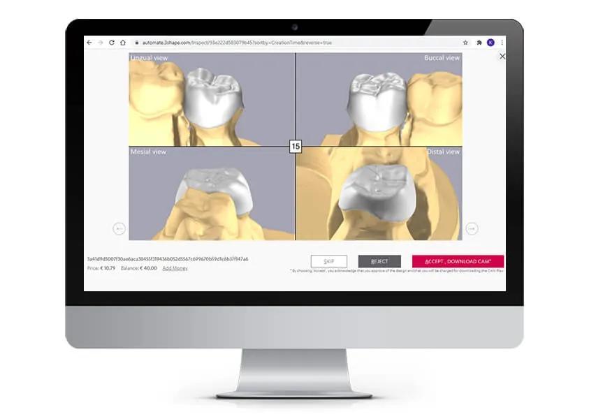 3Shape Releases Automate Design Platform for Labs