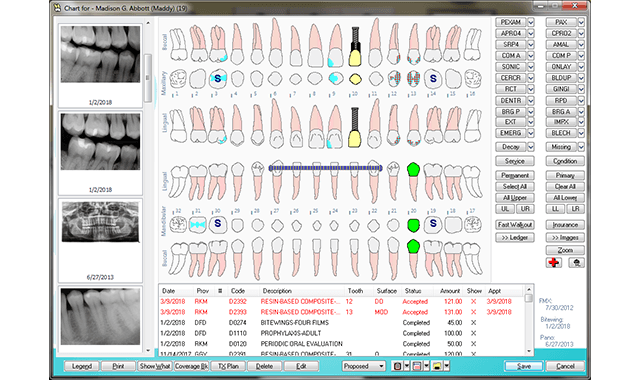 Patterson Dental announces Eaglesoft 20