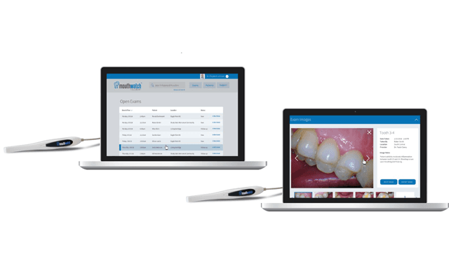 MouthWatch to debut TeleDent Referral Engine Starter Kit at 2018 Chicago Midwinter Meeting