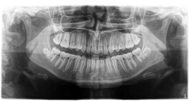 Digital Radiography Troubleshooting. Image credit: © Ivan – stock.adobe.com