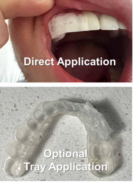 CrystLCare strips can be delivered directly onto the target dentition, or via a tray. | image Credit: © Greenmark Biomedical Inc.