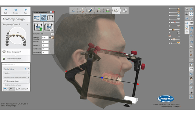 Whip Mix releases Bellus3D Dental Pro