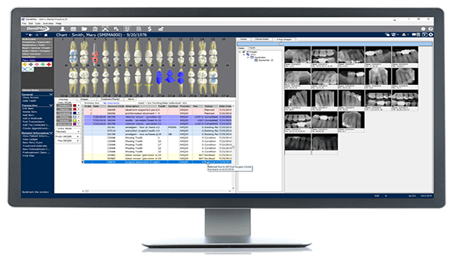 DentiMax 20 version available in cloud and server editions