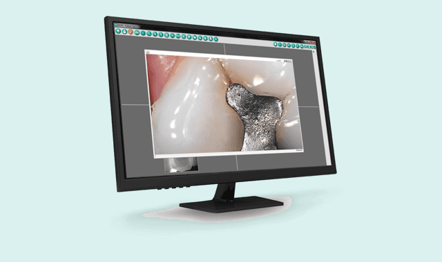 DEXIS introduces the new DEXcam™ 4 HD intraoral camera