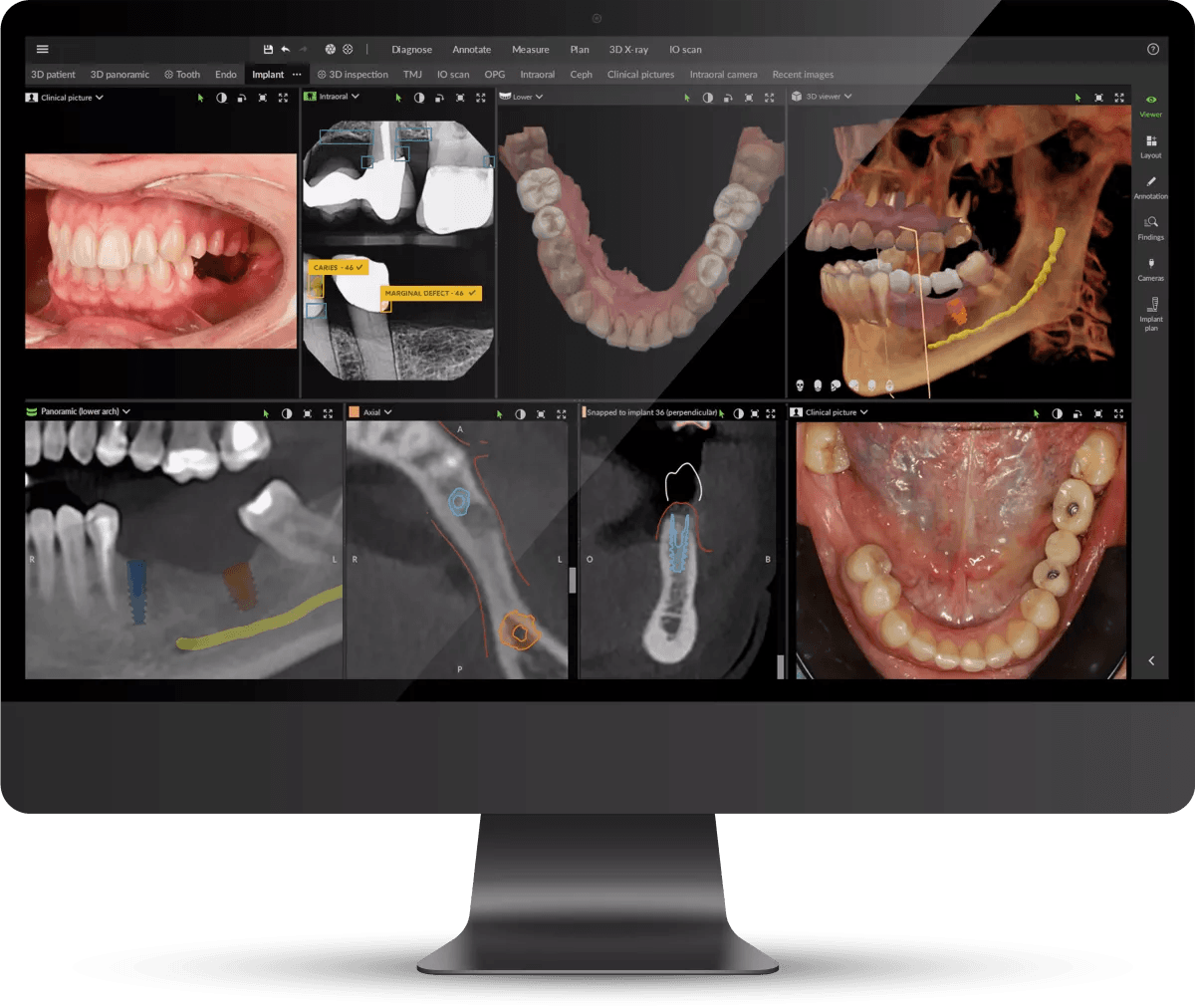 New DTX Studio™ Clinic Software Serves As the Unifying Software and Central Hub of the DEXIS Ecosystem | Image Credit: © DEXIS