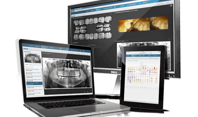 DEXIS and Dentrix Ascend team up for improved workflow options