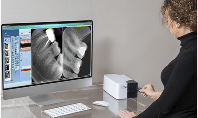 Owandy Radiology to showcase its small intraoral imaging plate scanner at GNYDM