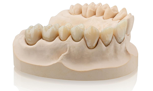 Formlabs, BEGO partner to bring 3D printed temporary and permanent crowns, bridges to dental industry