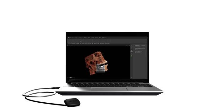 DEXIS Launches DEXIS Connect Pro for CBCT and Intraoral Sensor Devices. Image credit: © DEXIS
