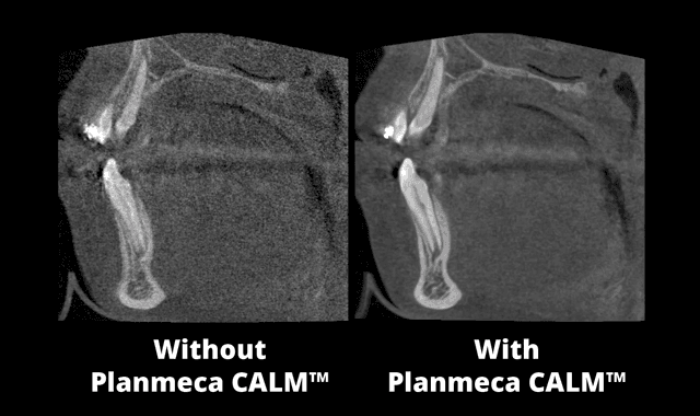 Planmeca introduces imaging solution