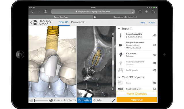 Dentsply Sirona launches Azento