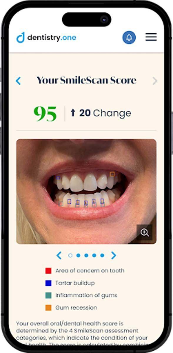 SmileScan from Dentistry.One. Image credit: © Dentistry.One