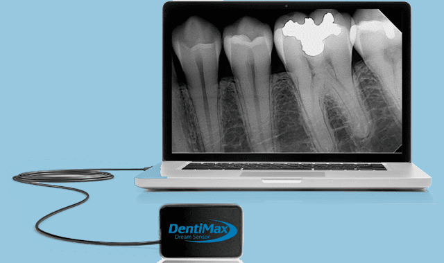 How DentiMax Dream Sensors made a big impact in one practice