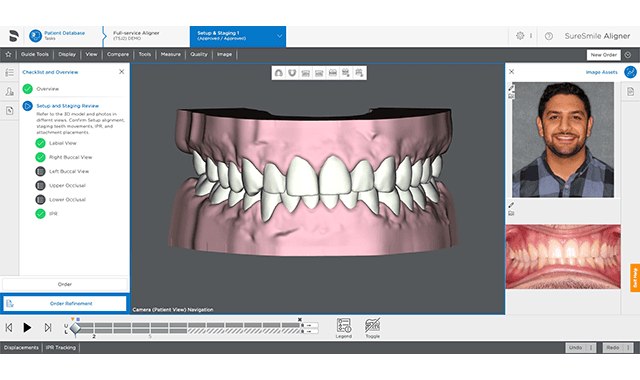 Dentsply Sirona updates SureSmile Aligner software