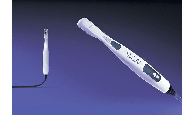 WOW intraoral scanner released in North America