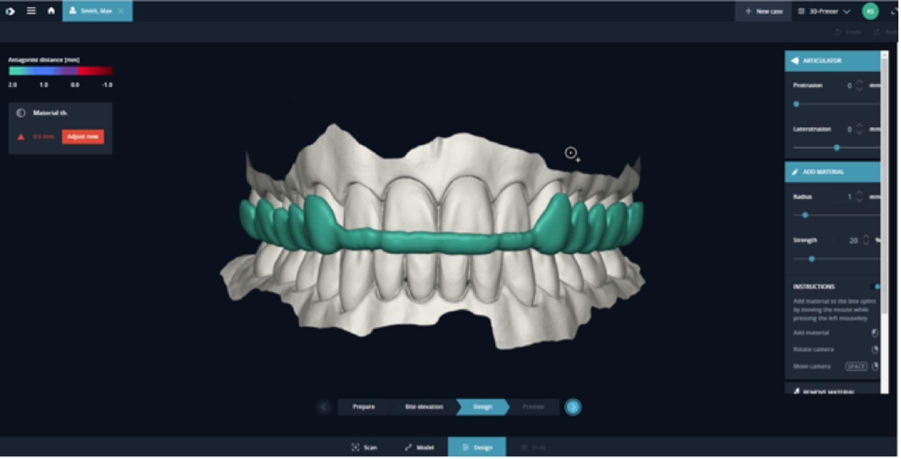 DentaMile from DMG: This cloud-based software makes it easy to integrate dental 3D printing into day-to-day work at your dental clinic or laboratory. | Image Credit: © DMG America