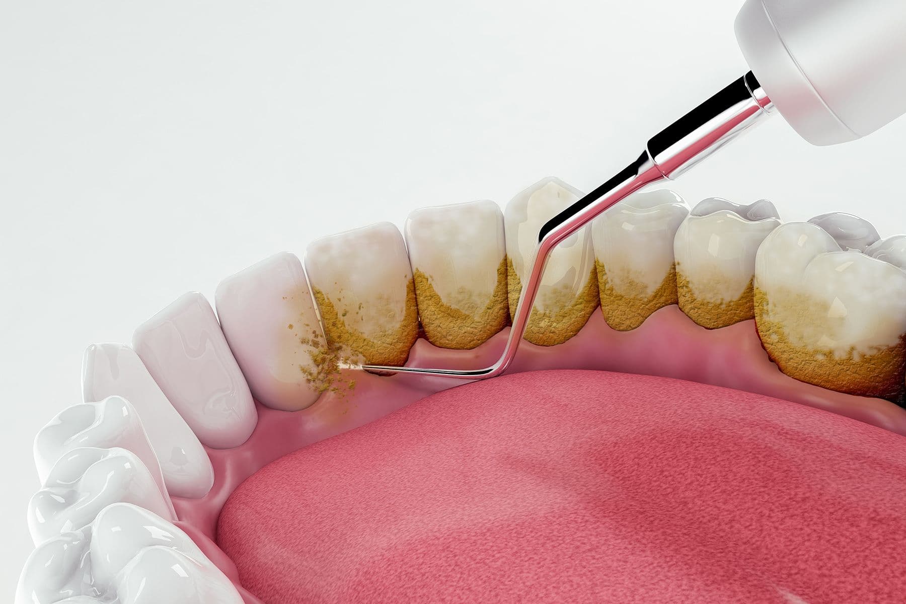 Pioneering a New Era in Periodontal Care: Embracing Advanced Techniques and Interdisciplinary Collaborative Strategies | Image Credit: © OSORIOartist - stock.adobe.com