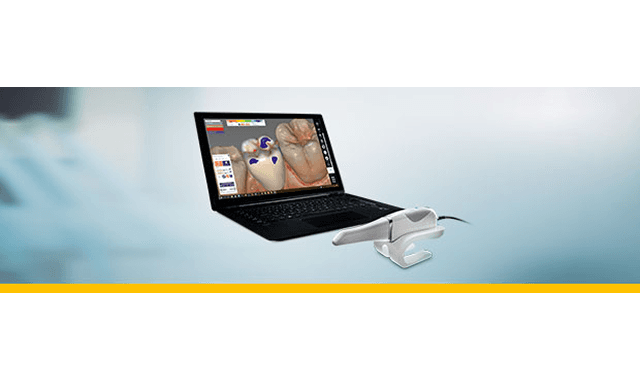 Carestream Dental offers doctors new restorative solution with exocad software interaction