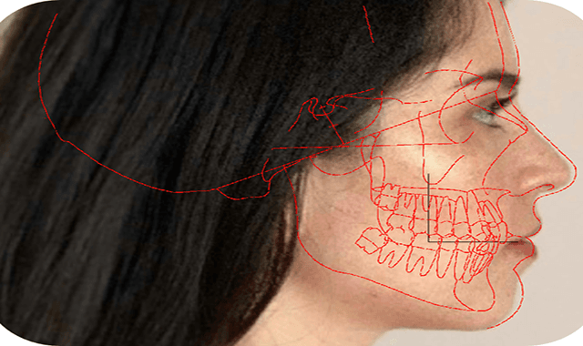 Bolton-Brush and Motion View partner for template system